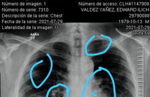 PRIORITARIO SEGUIR CON LA EMERGENCIA SANITARIA POR COVID19: OMS covid19
