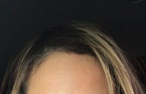 TESTIGO SINGULAR, TESTIGO ÚNICO, DIFERENCIAS