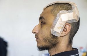 La paliza de Hedi R., gravemente herido por policías en Marsella, reconstruido minuto a minuto por la justicia